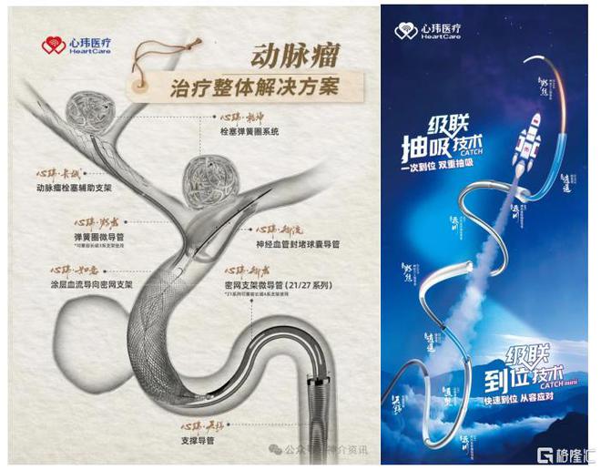 三大“中国智造”重磅亮相神经介入舞台解码心玮医疗-B（6609HK）的破局逻辑(图1)