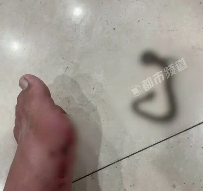 男子路边草丛方便被蛇咬下一秒抓蛇就医！